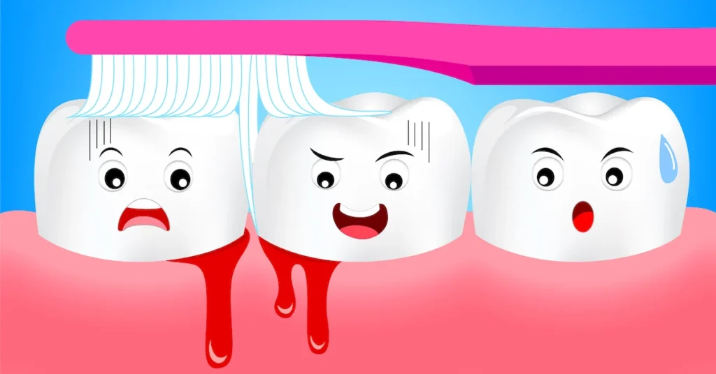Is Bleeding Gums an Early Sign of Gum Disease Chichester?